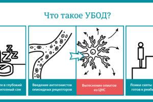 что такое убод